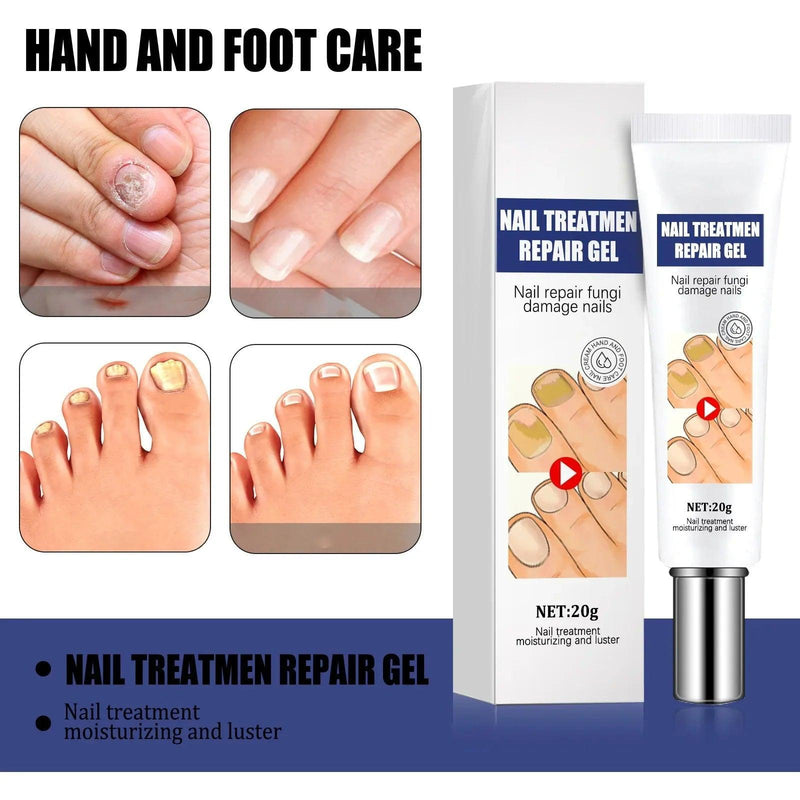 Creme da remoção de fungo, Tratamento do pé, Anti-infecção, Anti-Fungal, Onychomycosis, Paronychia - BrazilStory