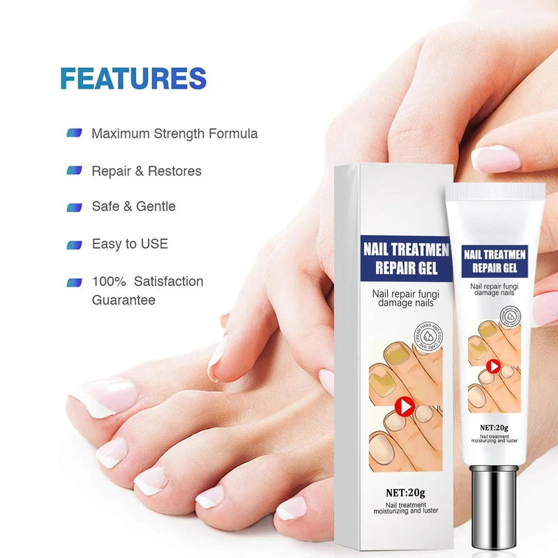 Creme da remoção de fungo, Tratamento do pé, Anti-infecção, Anti-Fungal, Onychomycosis, Paronychia - BrazilStory
